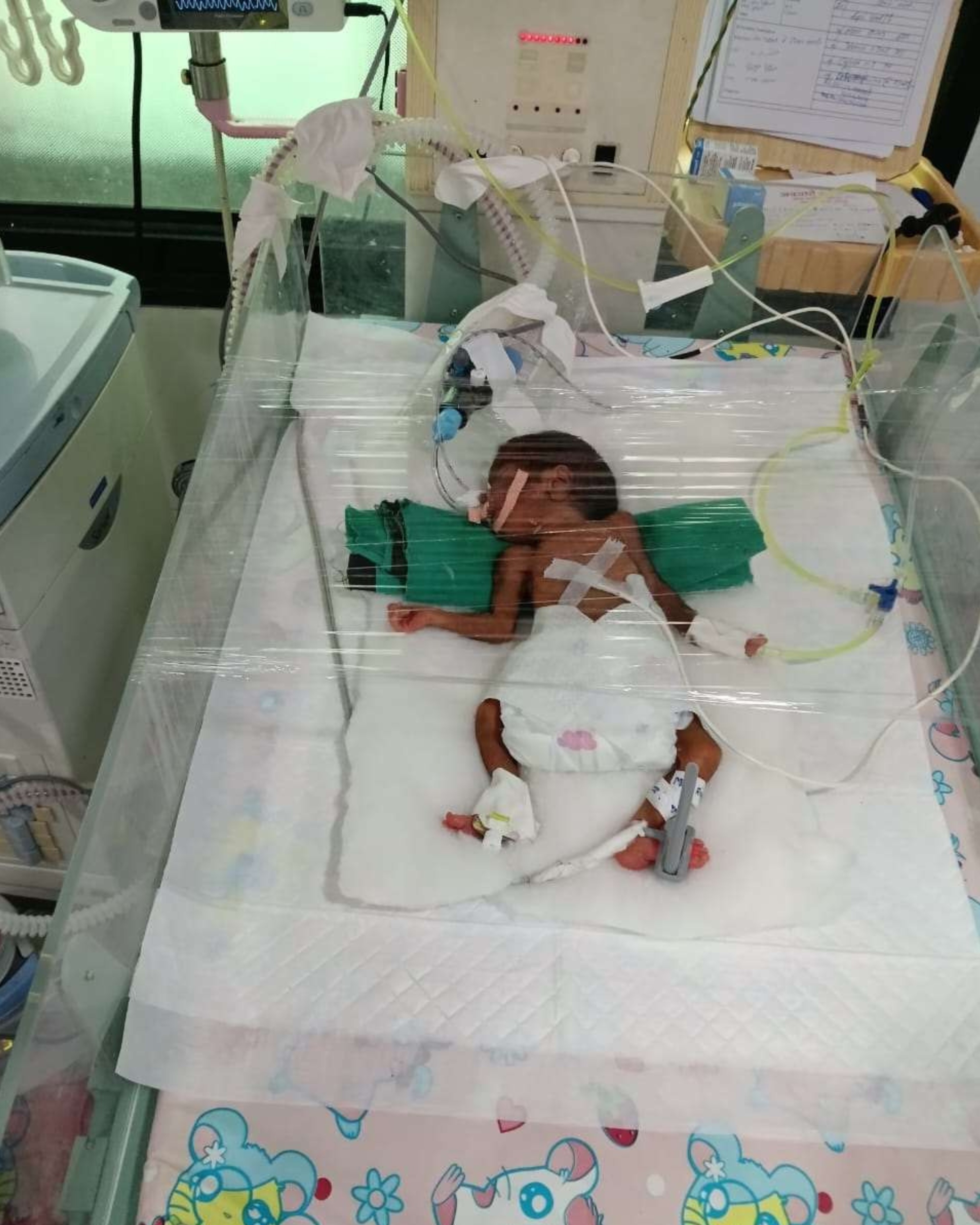 Baby of Sonal